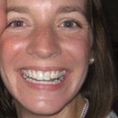 Jessica Schreiner, MS, RD, CSG, LD