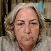 Susan Baumunk