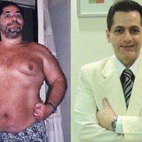 Bariatric Guru En Español