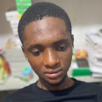 Nti Frank