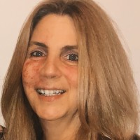 Dawn Tippett