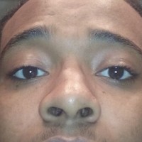 Quinlen Mosely