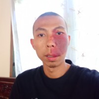 Adhi Yongki