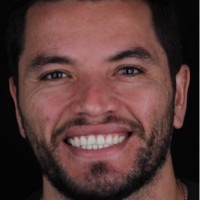 Marcelo Henrique Costa Lopes