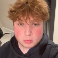Logan Strange