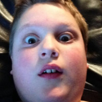 Fredrick Pimple