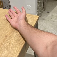Right Arm