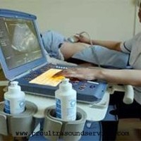 Mobile Ultrasound in Queens NY
