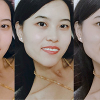 王百慧