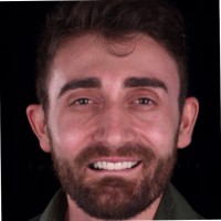 Fatjon Ignjatic