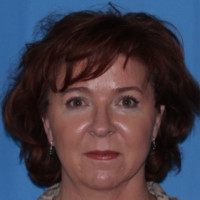 Shirley Wise