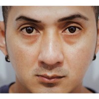 Andi Irfanto