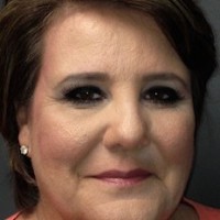 Carol Rachunek
