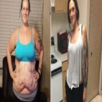 Fast Weight Loss Fast Weight Loss