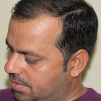 Vijay Kaser