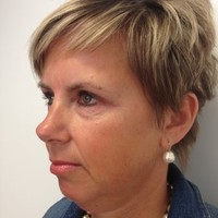 Anne Peeters