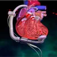 Nwanneka Okoro CCP, FPP, LP, MBA