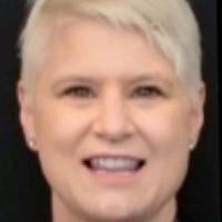 Lisa Schleis