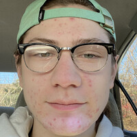 Jacob Streng