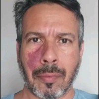 Kadu Nogueira
