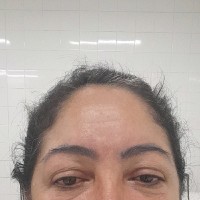 Dalva Almeida Dias Almeida