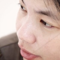 Alesxis Lim