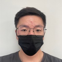 Marcus Teo Kai Xiang