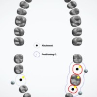 Viet Dental Lab (Vietnam Dental Outsourcing)