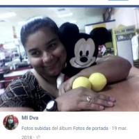 mi dva