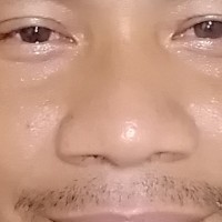 Ronel Asuncion