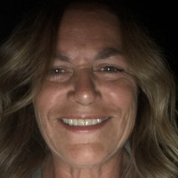 Terri Verderese