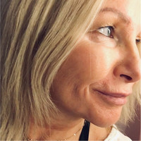 Anki Svanström