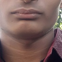 Mitul Patel