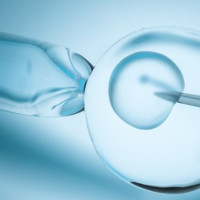 Invitro Fertilization