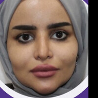 Mona Alanazi