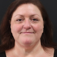 Terri Benson