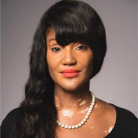 Arese Pollard