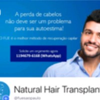 Natural Hair Transplant