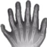 Manny Sixfingers