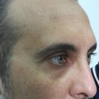 Mohamed Samara