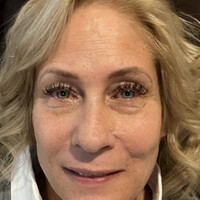 Teri Bart