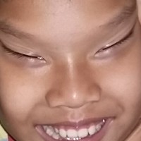 Andra a