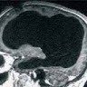 Brain Less