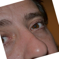 André Stoll