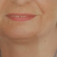 Giancarla Acn Arnoni