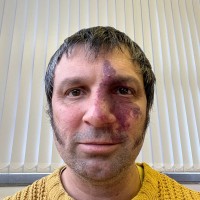 Craig Storey