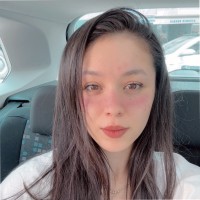 Buse KILINÇ