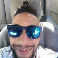 Mikey G Scars