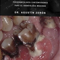 Agustin Zeron