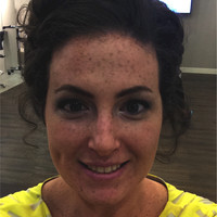 Kirsten Demarco